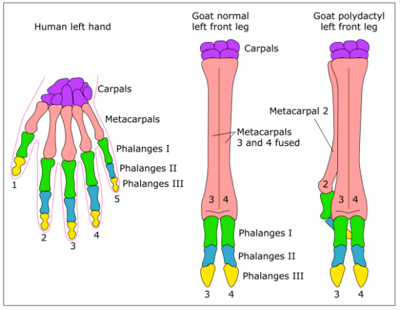 metacarpal bones